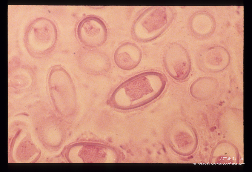 Rodent liver. This high power view shows the plugs at both ends of the egg, the dense dark inner shell layer and the outer lighter layer which appears to be divided.