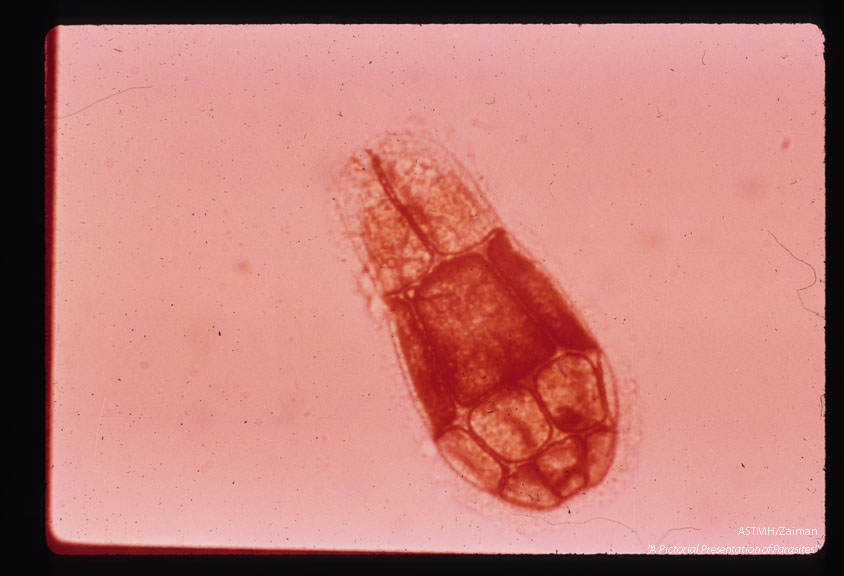 Epidermal plates of miracidium impregnated with silver nitrate.