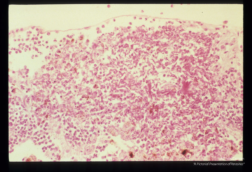 Severe retinal necrosis and eosinophilic retinitis in an experimentally infected cynomolgus monkey.