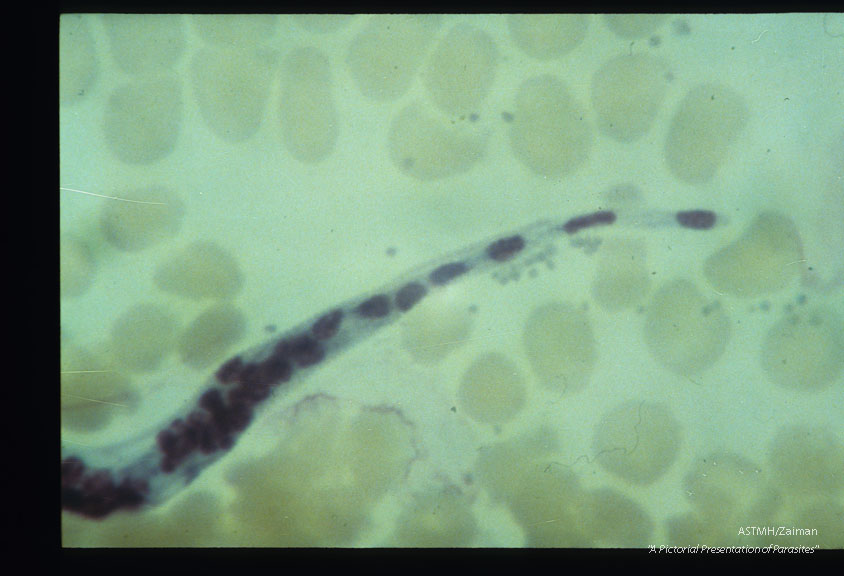 Microfilaria; posterior end.