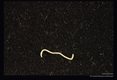 Same worm after removal through gastroscope.