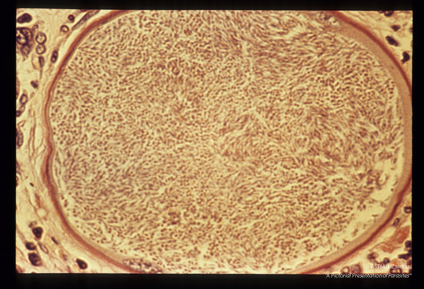 Cysts in low and high powers.