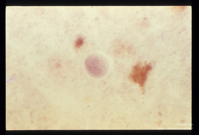 Cysts in stool, showing various numbers of nuclei, hematoxylin stain.