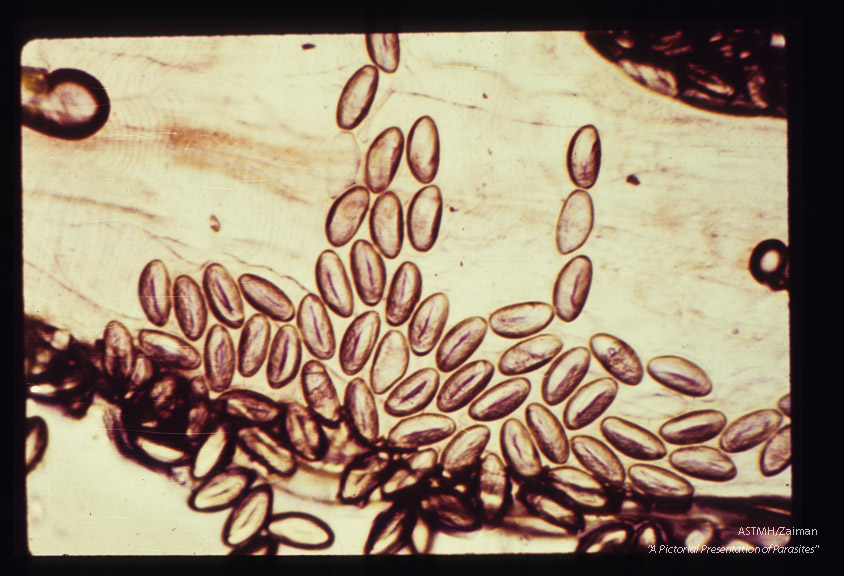 Egg at various magnifications. In the highest power, the embryo is seen.