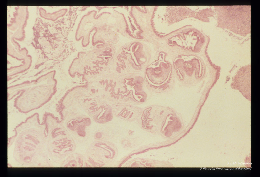 Multiple sections showing membranes, suckers and hooks.