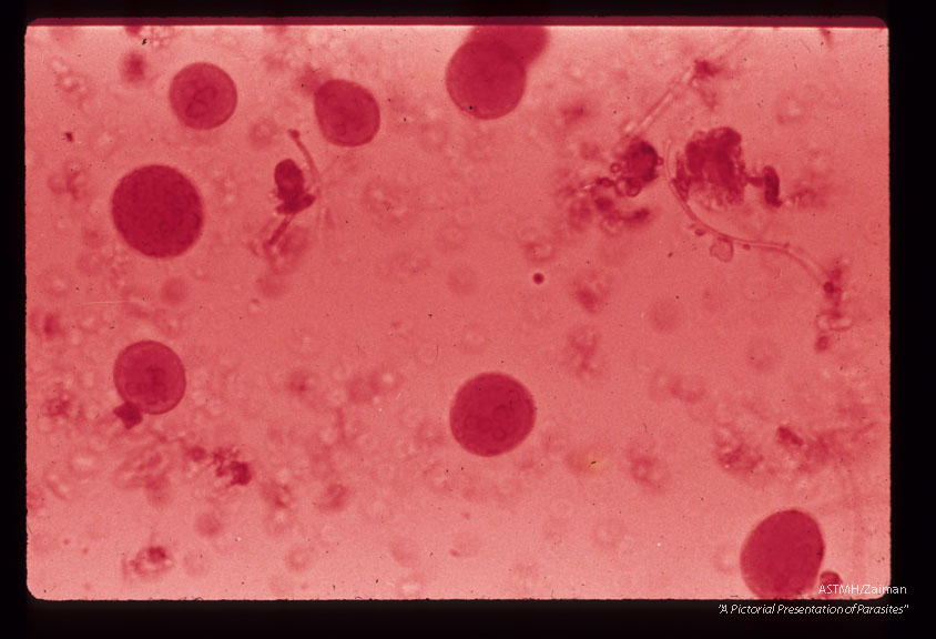 Iodine stained cysts in stool showing different numbers of nuclei.