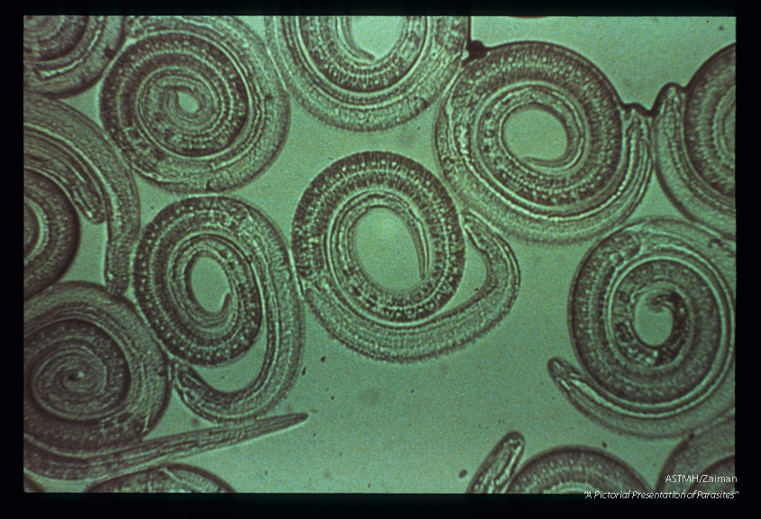 Muscle larvae. Isolated by pepsin digestion.
