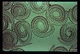 Muscle larvae. Isolated by pepsin digestion.