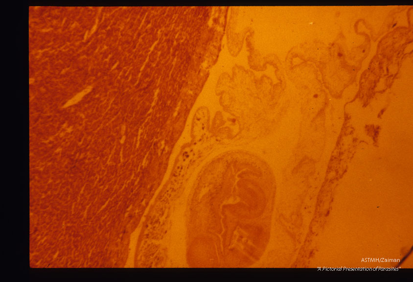 Usually the cysticerci of this tapeworm are found in rabbits. Very rarely they may be found in the definitive he (dog). This is such a case with slide (1867) showing gross and slide (1868) the microscopic pathology.