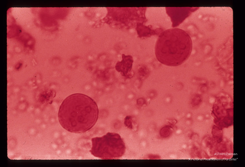 Iodine stained cysts in stool showing different numbers of nuclei.