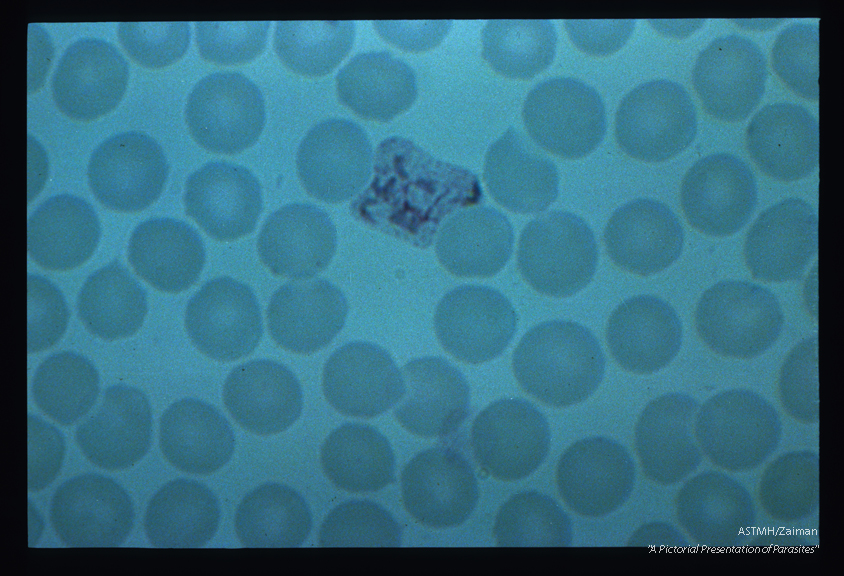 Trophozoites. The irregular dispersion of cytoplasm is evidence of the mobility of the parasite.