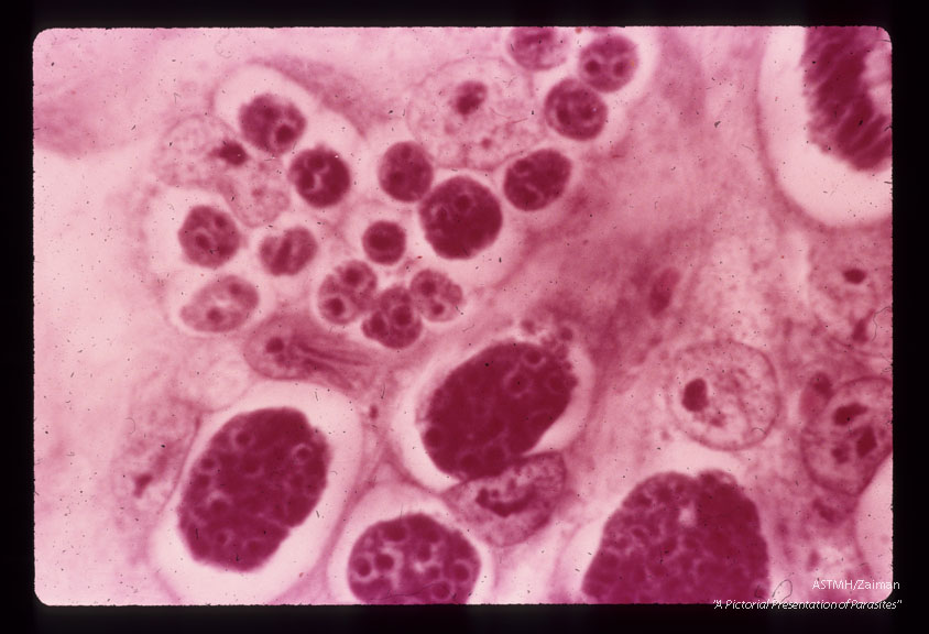 Immature second-generation schizonts. Note multiple infections of single cells. H & E stain. (96 hr).