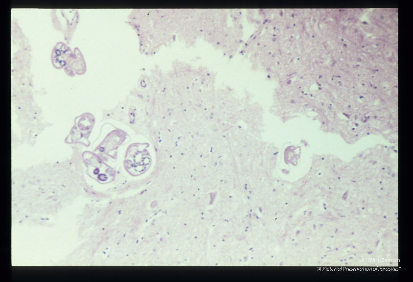 Longitudinal and cross-section of larvae in the spinal cord.