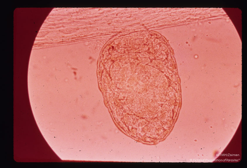 Sporocyst.