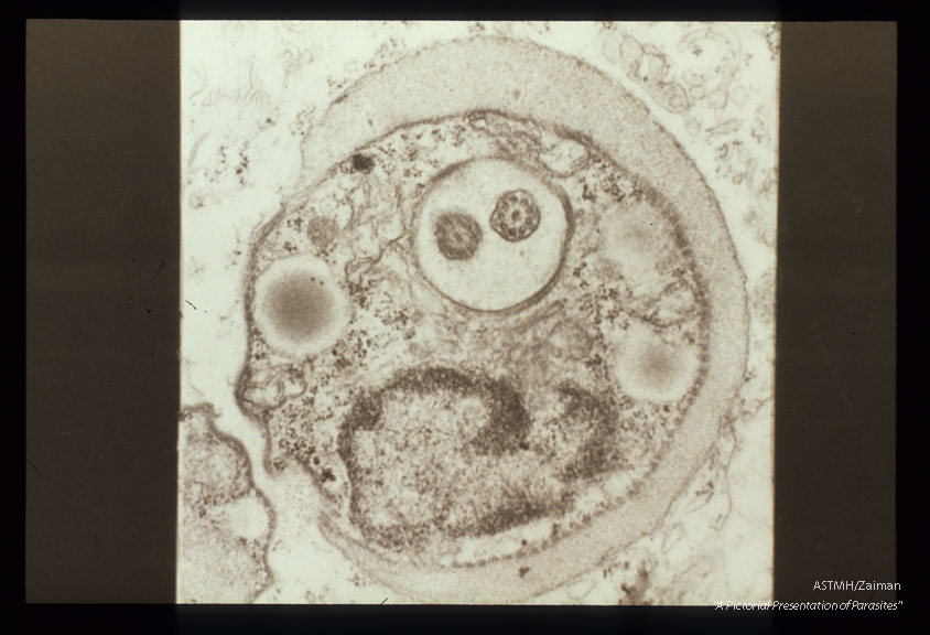 A single specimen in early division with doubled flagellum and large nucleus.