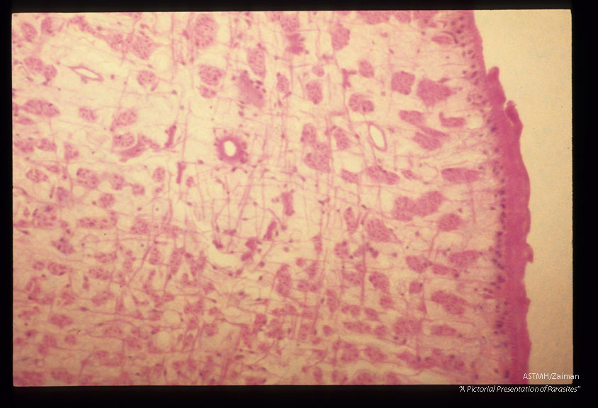 Multiple cross sections through the parasite at various magnifications are presented.