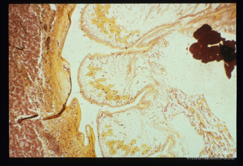 Liver sections at different magnifi­cations.