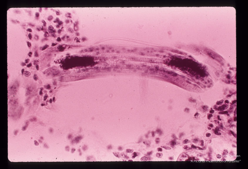 Larvae in alveoli.