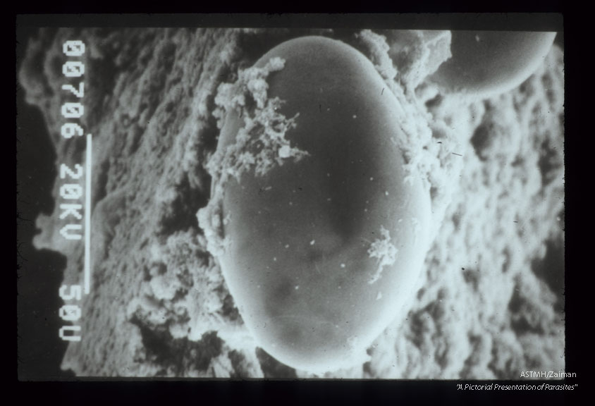 SEM studies of eggs.