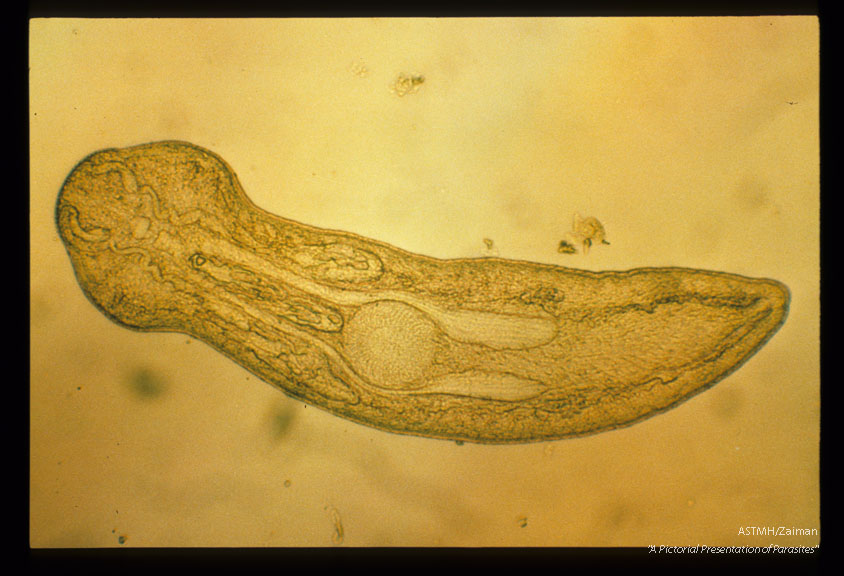 Living mesocercaria removed from a human liver at autopsy.