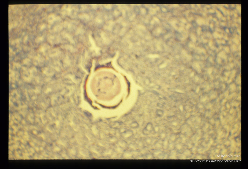 Section through larval nerve ring.