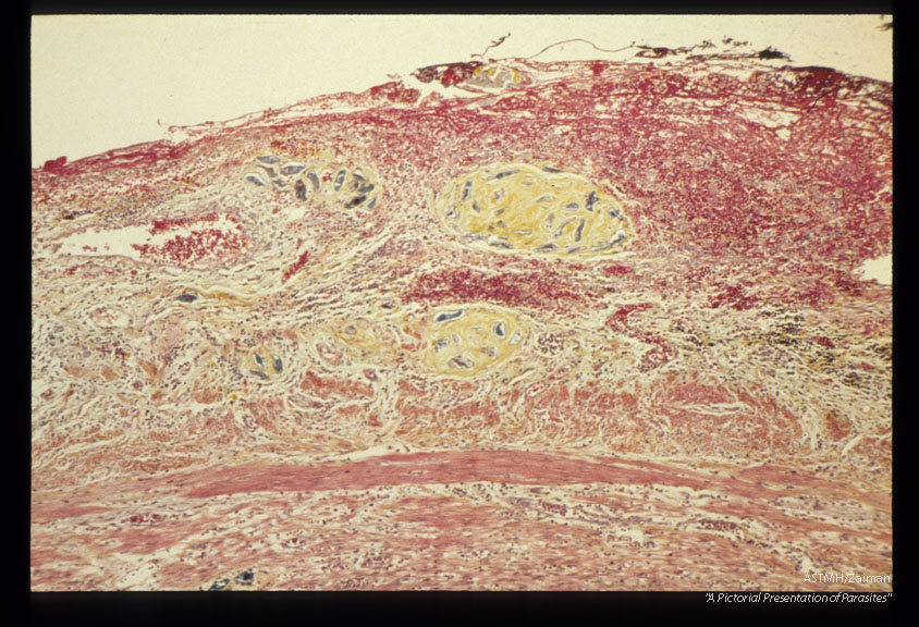 Multiple sections through appendix.