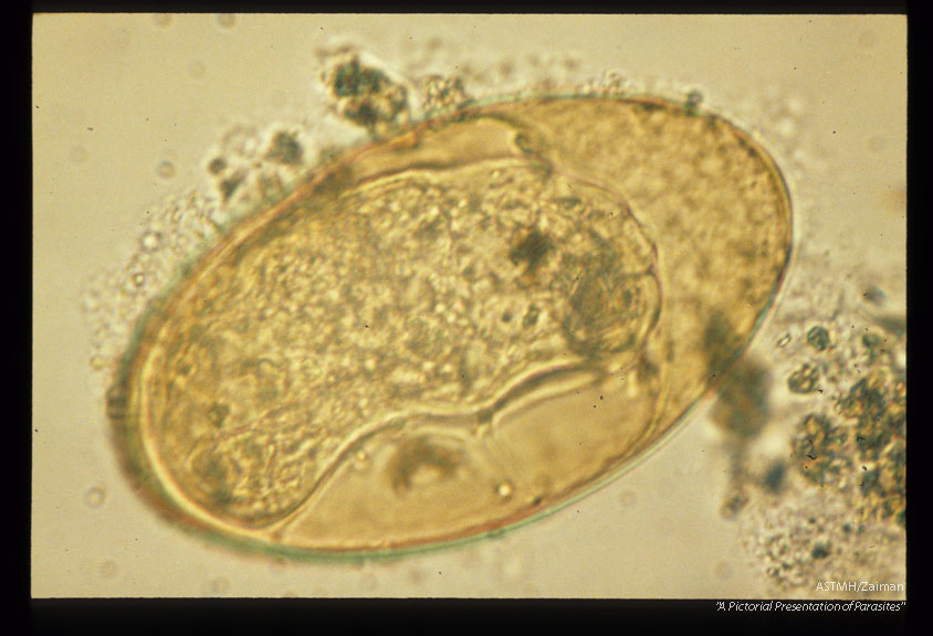 Egg showing miricidium.