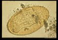 Egg showing miricidium.