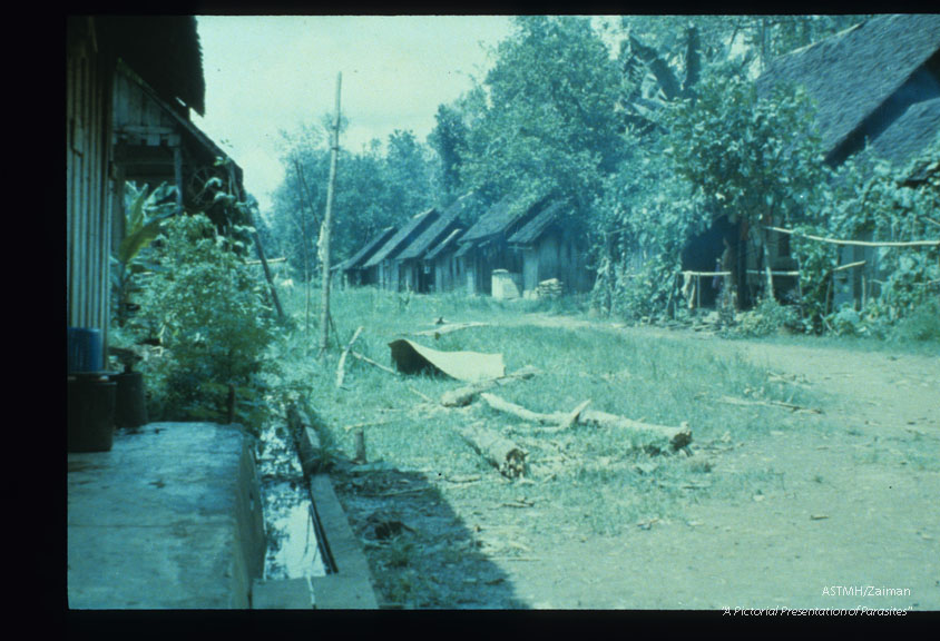 Sub-periodic type. Endemic filariasis present in village adjacent to wet forest in S. Kalimantan, Indonesia.