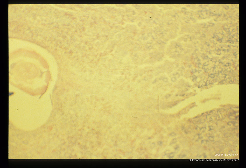 Photomicrograph of section through larvae in the submucosa of a pig.