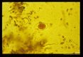 Oocysts, iodine stained and unstained in stool
