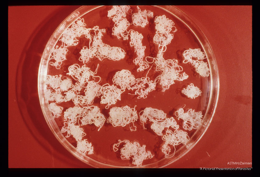 Female worms isolated from a single nodule in a boy of about thirteen from the Bougouriba-River in Upper Volta.