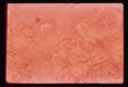 Free hooklets in renal cyst sand.