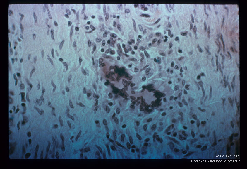 Giant cell formation in the inflammatory response.