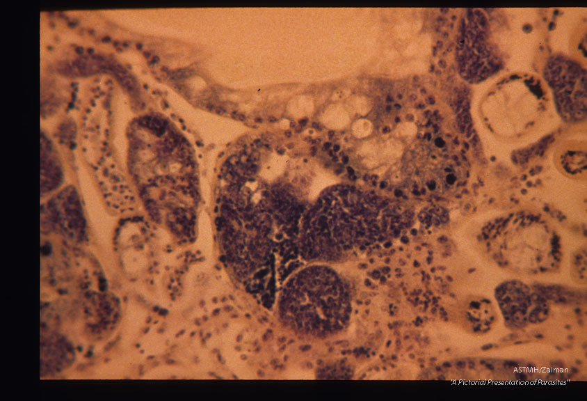 Sections through snail (Biomphalaria glabrata) liver containing sporocysts 54 days after infection.