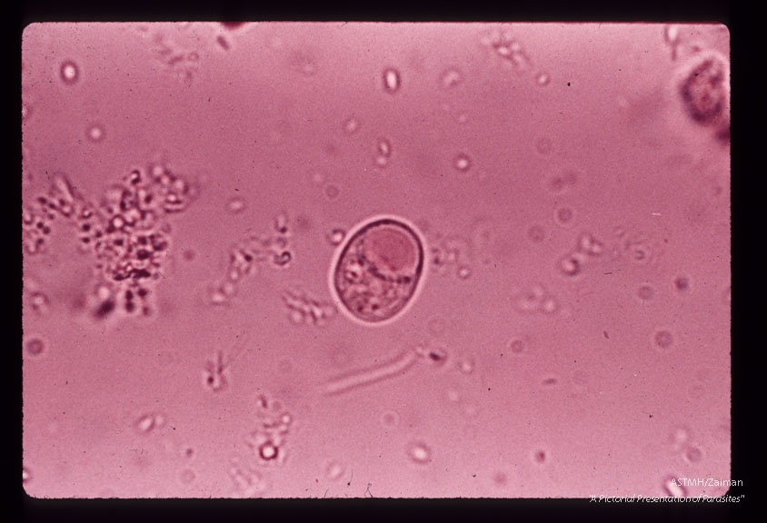 Cyst in feces. Iodine stained wet mount.