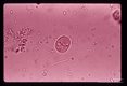 Cyst in feces. Iodine stained wet mount.
