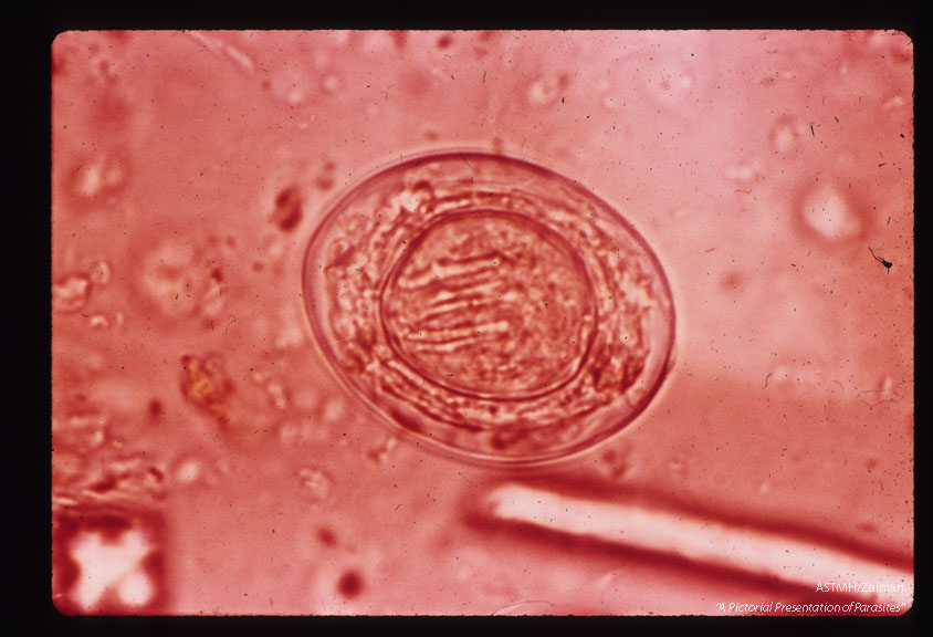 Egg in iodine stained stool emulsion.