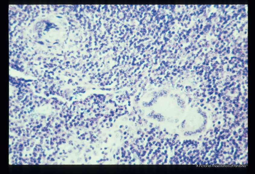 Giant cell granulomata induced in mesenteric lymph nodes by experimental infection in Erythrocebus patas.