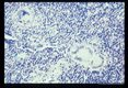 Giant cell granulomata induced in mesenteric lymph nodes by experimental infection in Erythrocebus patas.
