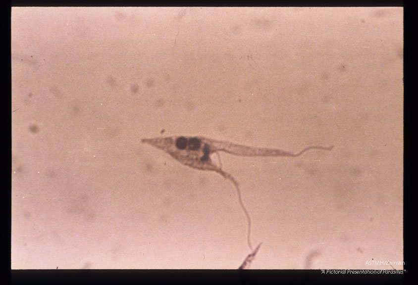 Peru strain epimastigote dividing in supernatant of infected Hela cell culture.