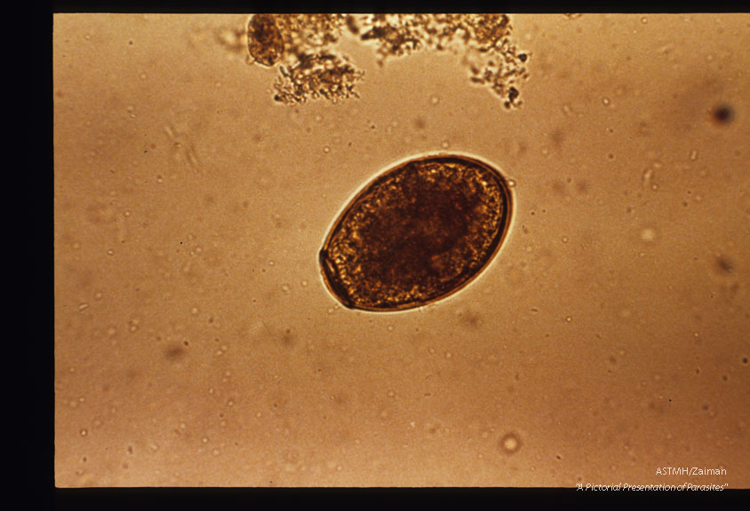 Egg, iodine stained, in stool.