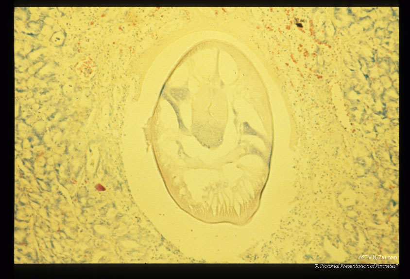 Anterior end of a larva in submucosa of miniature pig.