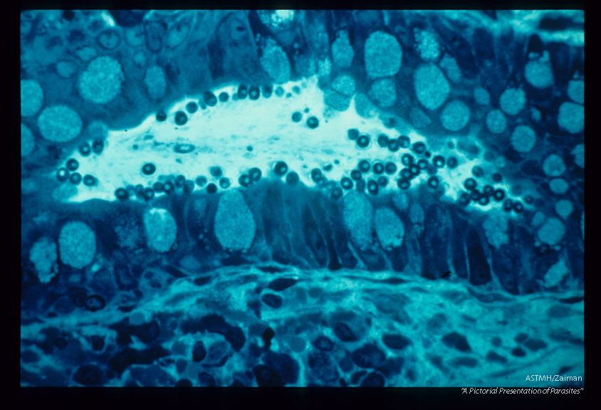 Photomicrograph showing parasites inrectum. Toluidine blue stain.