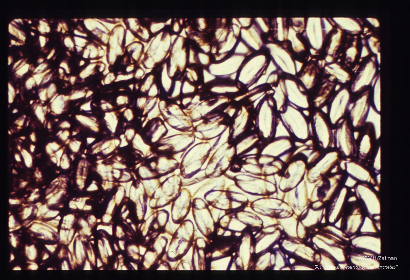 Egg at various magnifications. In the highest power, the embryo is seen.