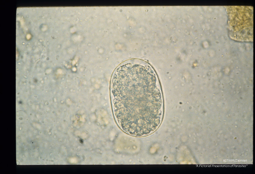 Sequence showing development of larva in egg.